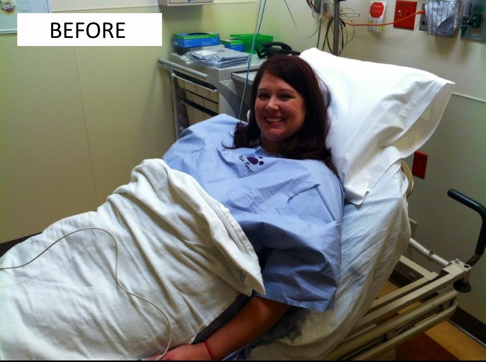 Gastric bypass before and after--Rochelle Goforth--Before