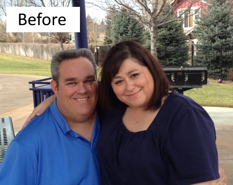 Duodenal switch before and after photos--Chris and Lisa Before