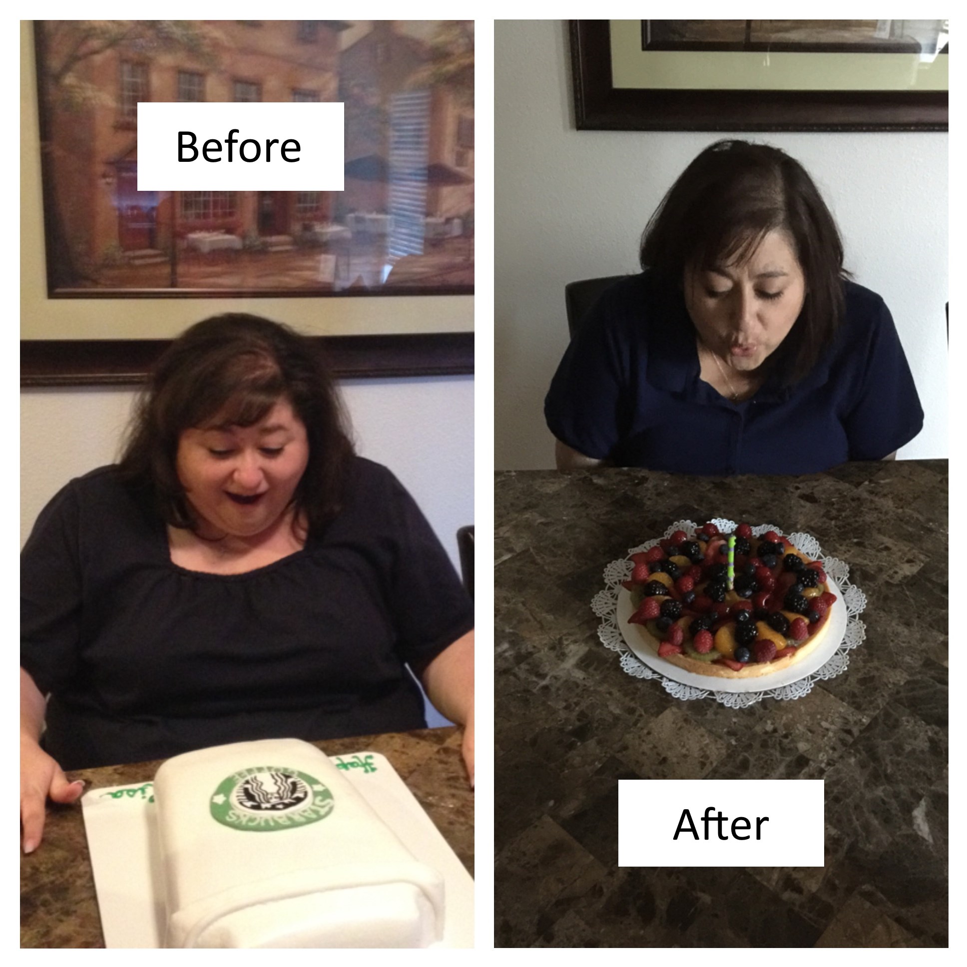 Duodenal switch before and after--Chris and Lisa