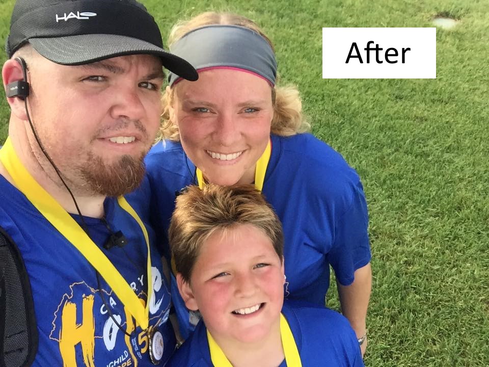 gastric sleeve testimonial 3--Karl